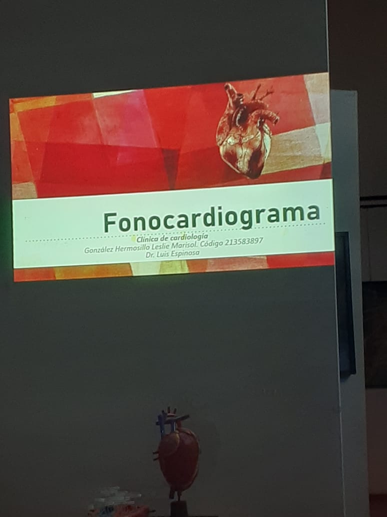 Diapositiva con el título Fono-cardiograma