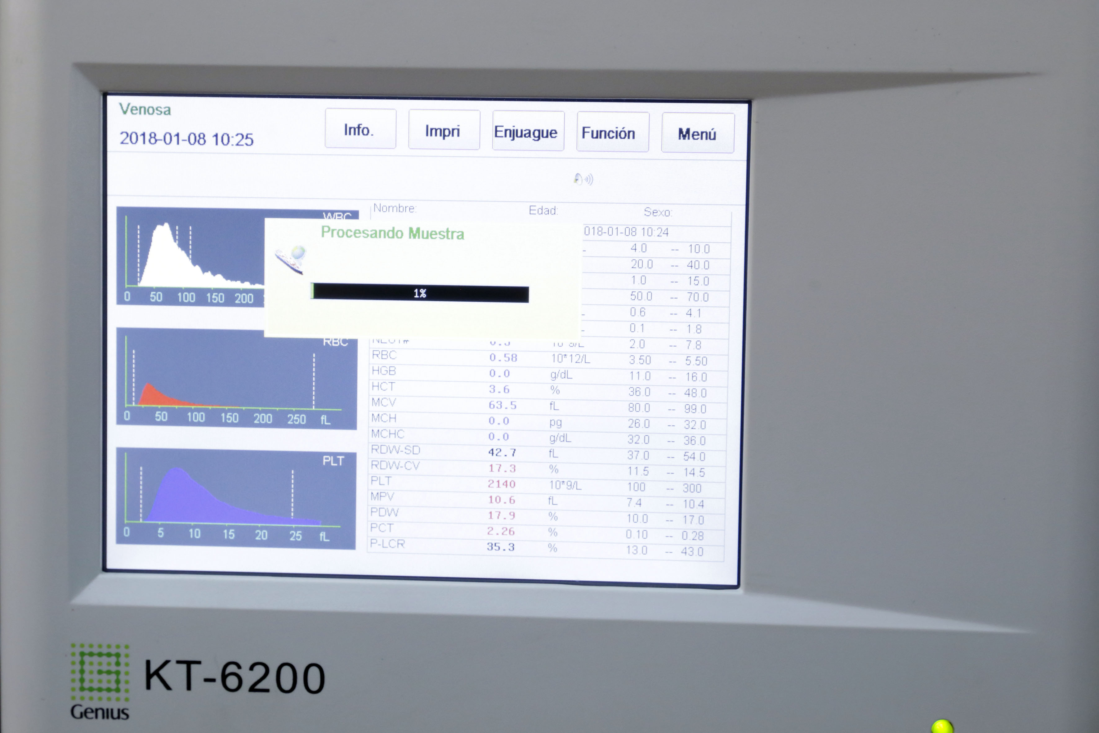 Datos de la investigación en el monitor de la computadora