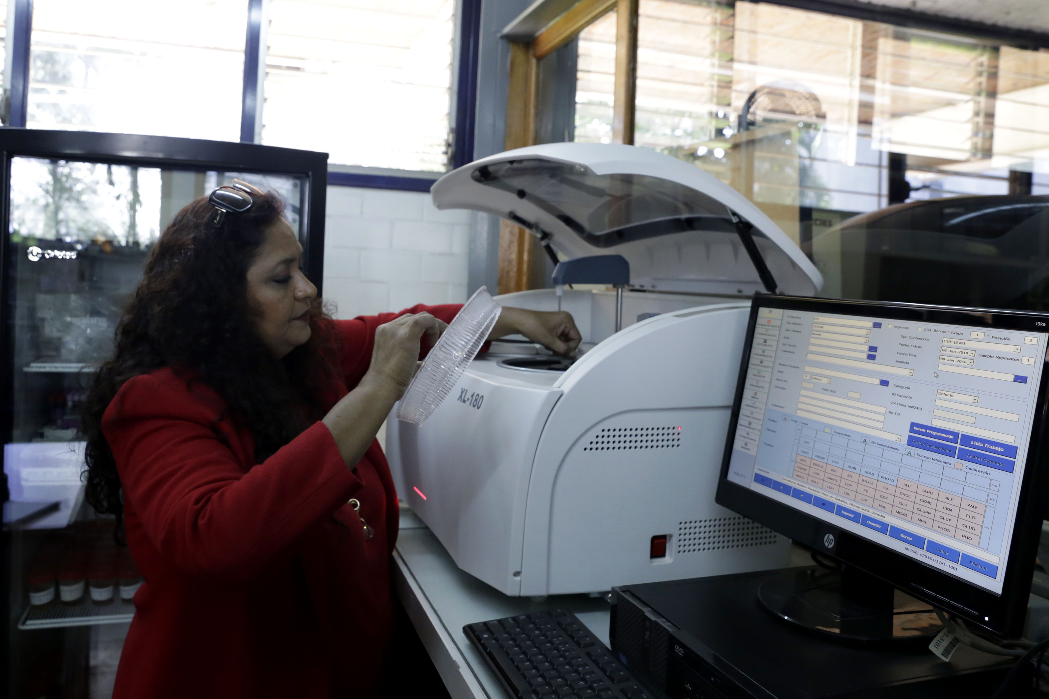 Investigadora analizando muestras de sangre