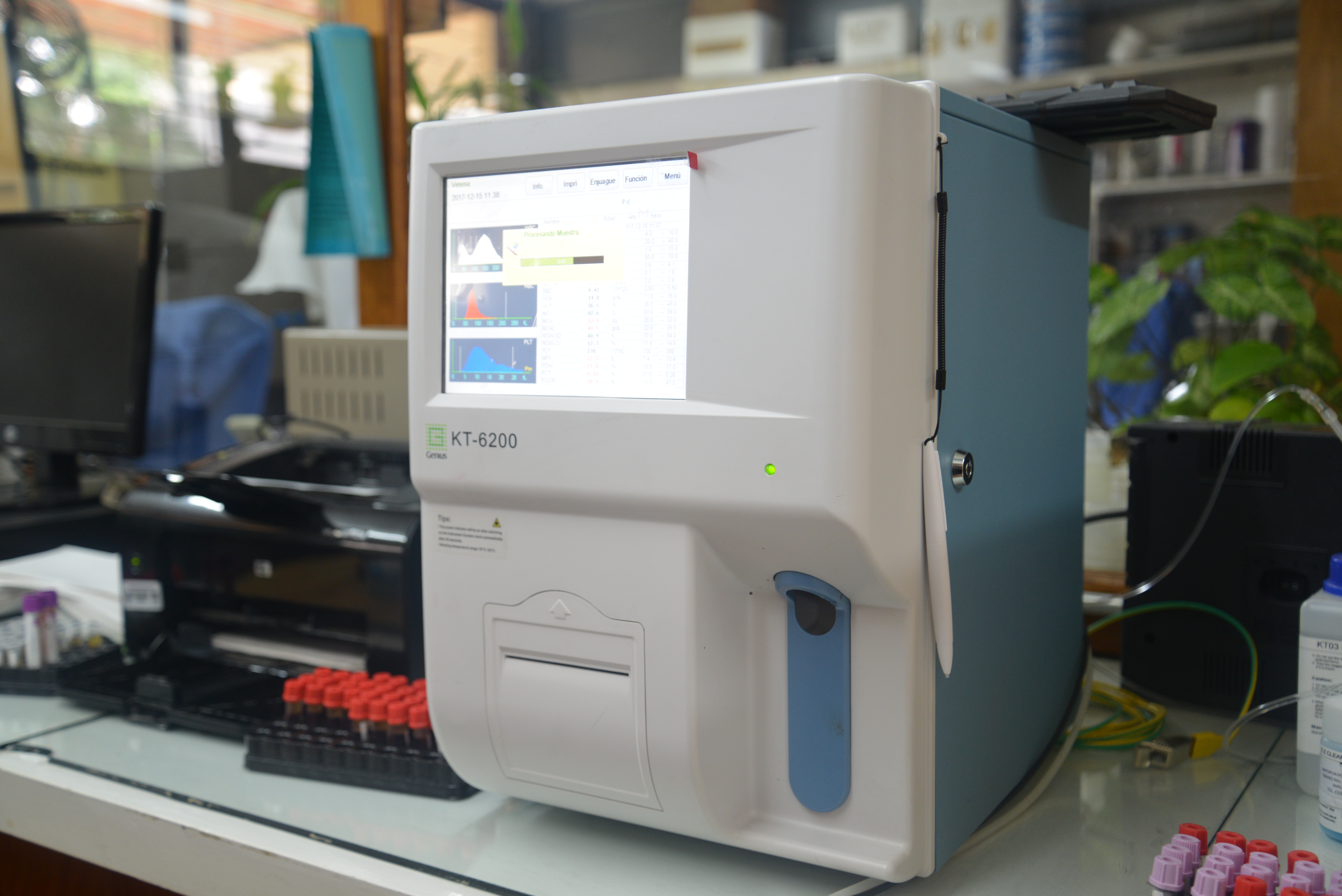 Equipo para biometría hemática