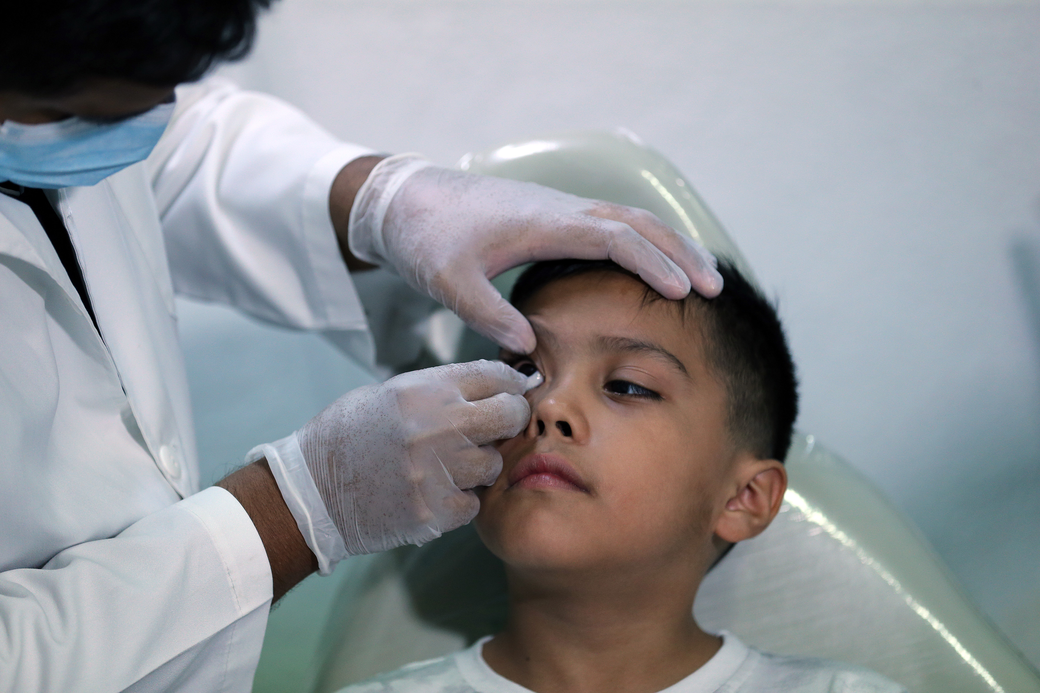 Médico especialista coloca prótesis ocular en el ojo derecho del niño