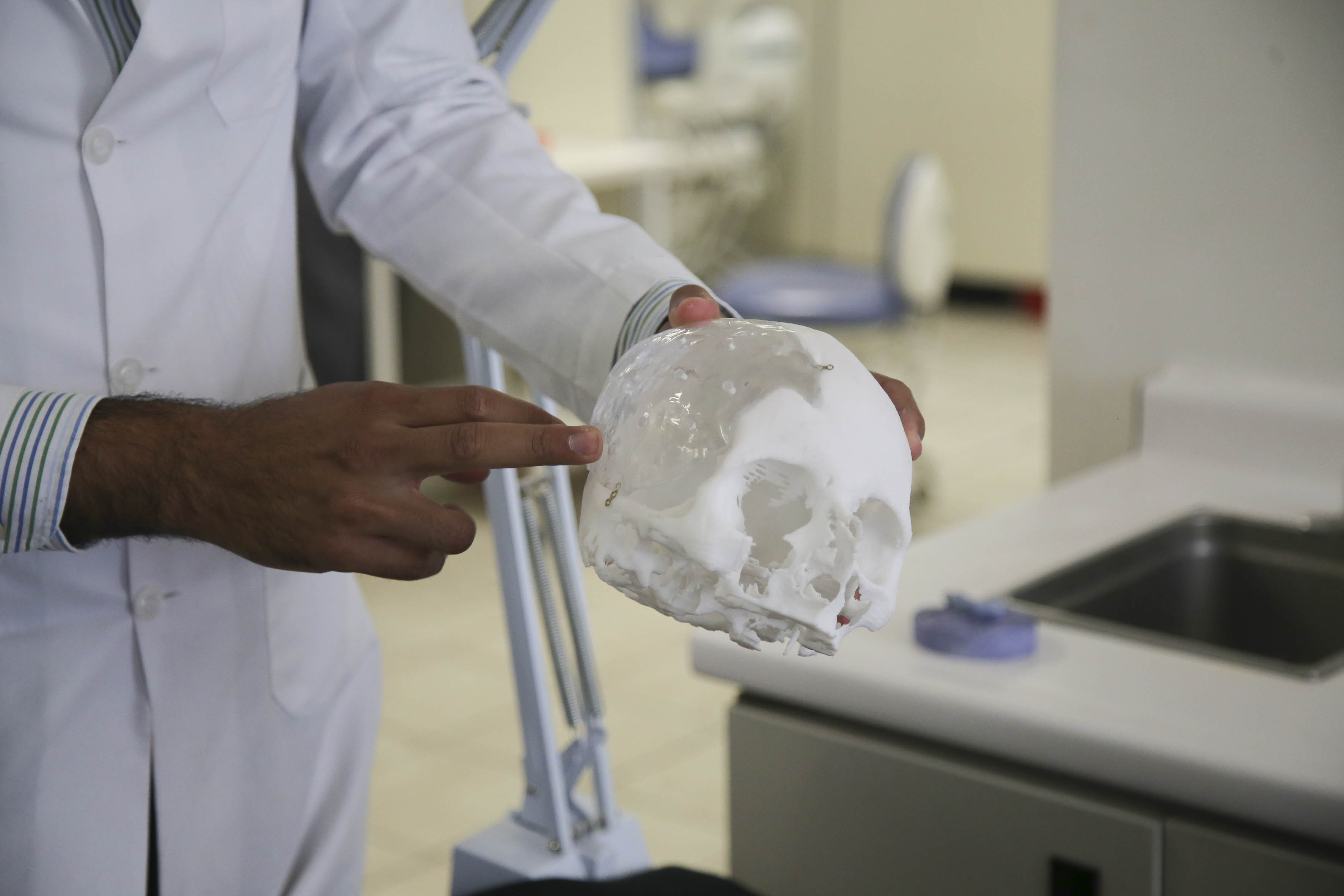 Prótesis de cráneo en acrílico