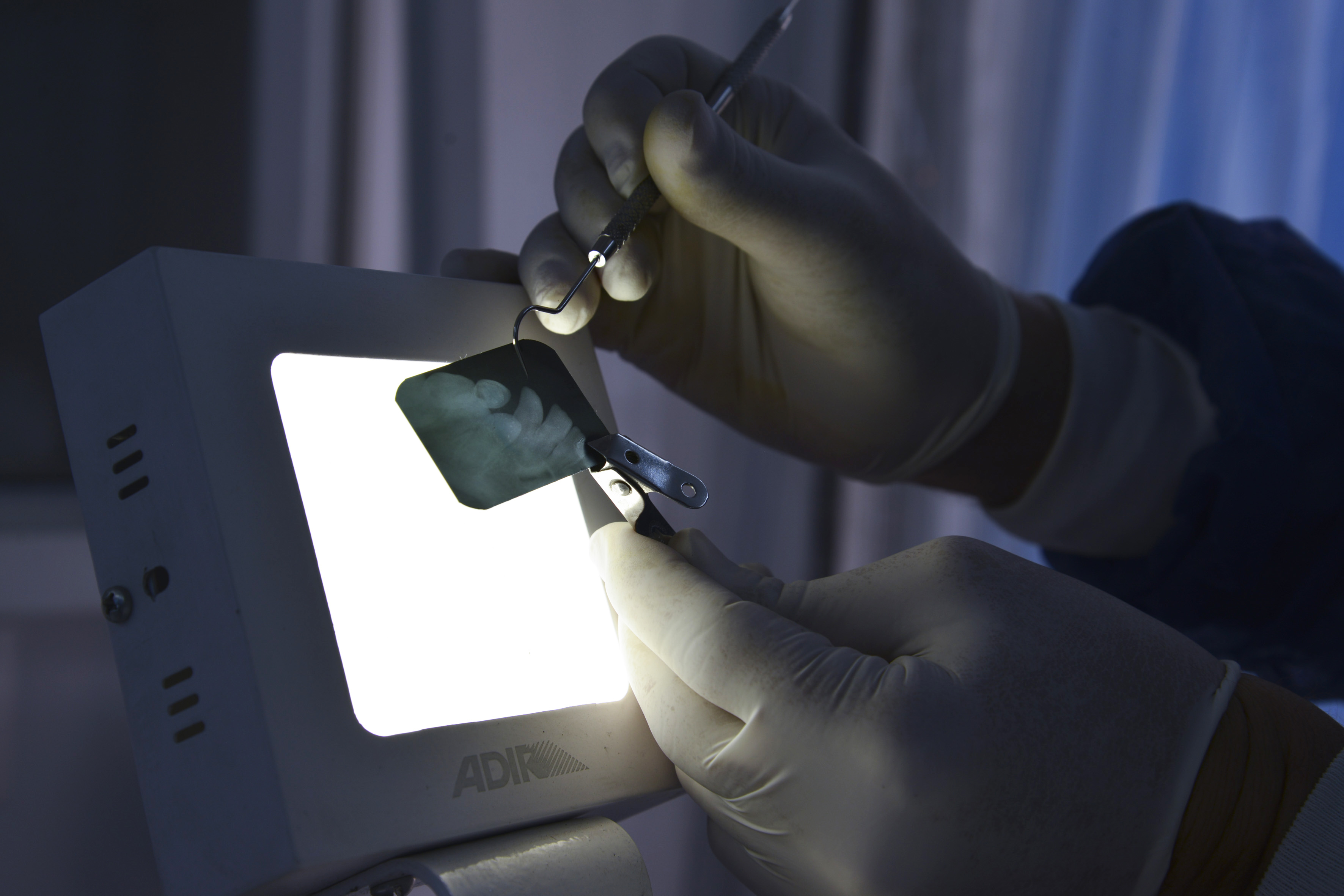 Odontólogo visualizando radiografía en cuarto oscuro de la Unidad Móvil Odontológica
